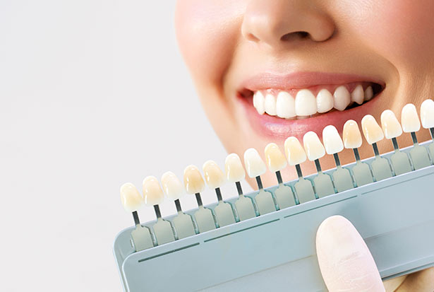 Qué ventajas tiene nuestro tratamiento de blanqueamiento dental en Móstoles