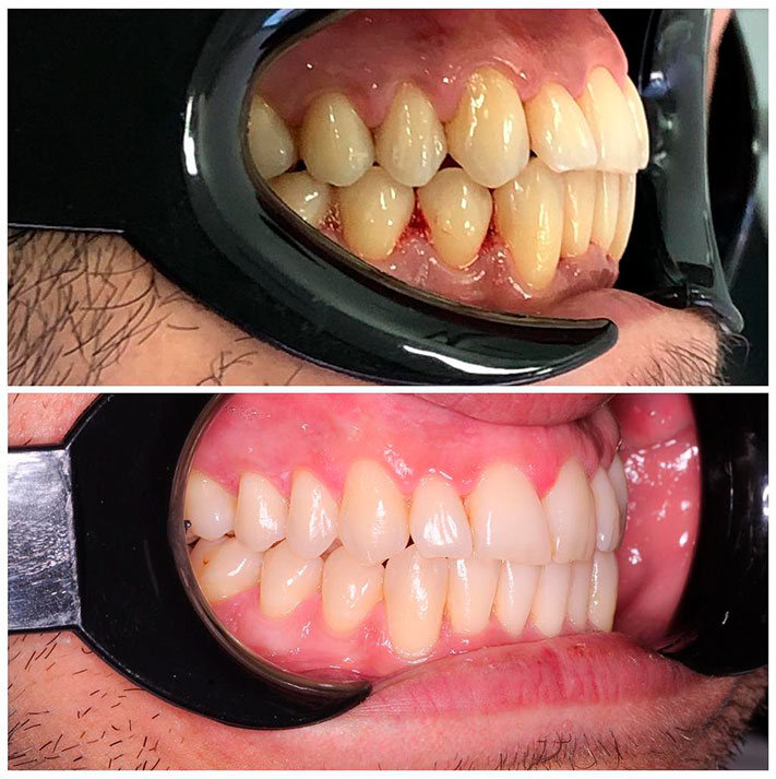 esencial higiene bucal para ortodoncia
