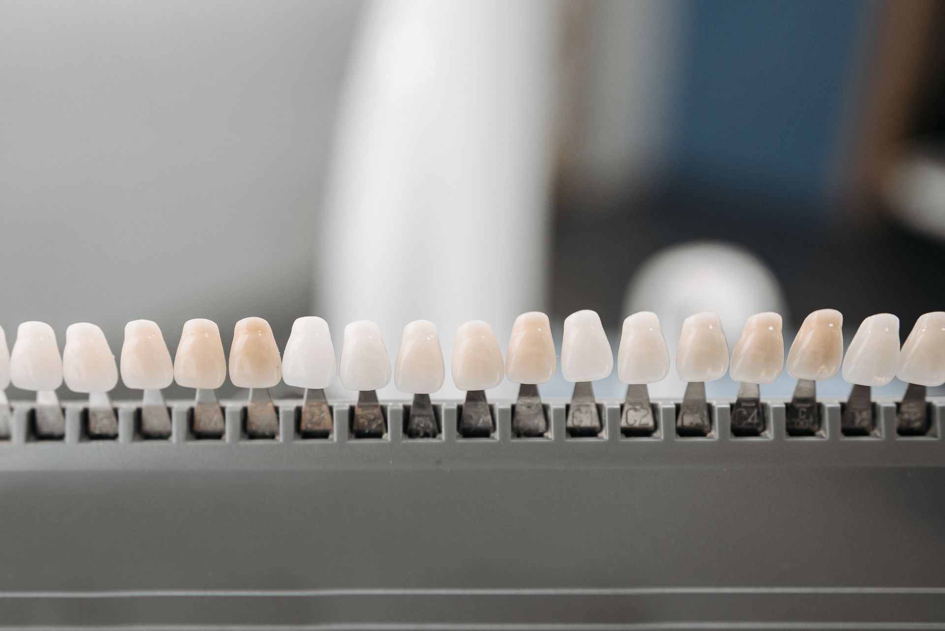 Diferencias entre carillas de composite porcelana